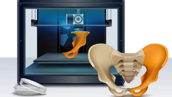 3d printer printing human bone